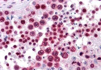 Immunohistochemistry-Paraffin: HMGB2 Antibody (3D2) [NBP1-69801] - Analysis of anti-HMGB2 antibody with human testis at concentration 5 ug/ml.