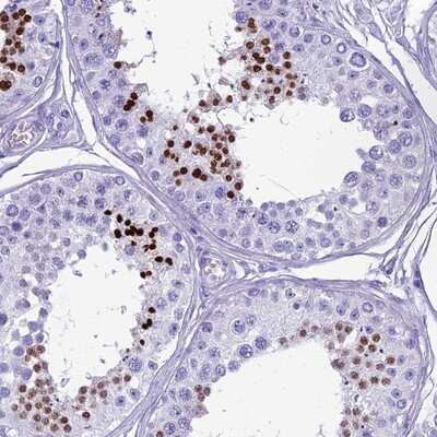 Immunohistochemistry-Paraffin: HMGB4 Antibody [NBP1-93780] - Staining of human testis shows strong nuclear positivity in a subset of cells in seminiferus ducts.
