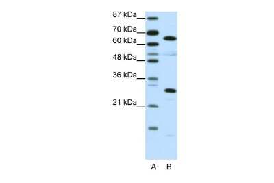 Western Blot: HMGB4 Antibody [NBP2-83050] - WB Suggested Anti-HMGB4 Antibody Titration: 0.2-1 ug/ml. ELISA Titer: 1:62500. Positive Control: Jurkat cell lysate