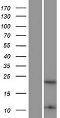 Western Blot: HMGB4 Overexpression Lysate (Adult Normal) [NBP2-05484] Left-Empty vector transfected control cell lysate (HEK293 cell lysate); Right -Over-expression Lysate for HMGB4.