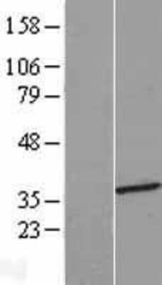 Western Blot: HMGCLL1 Overexpression Lysate (Adult Normal) [NBL1-11618] Left-Empty vector transfected control cell lysate (HEK293 cell lysate); Right -Over-expression Lysate for HMGCLL1.
