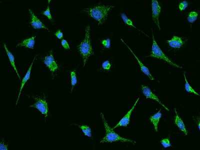 Immunocytochemistry/Immunofluorescence: HMGCS1 Antibody [NBP2-97737] - Immunofluorescence staining of HMGCS1 in Hela cells. Cells were fixed with 4% PFA, permeabilzed with 0.1% Triton X-100 in PBS, blocked with 10% serum, and incubated with rabbit anti-Human HMGCS1 polyclonal antibody (dilution ratio 1:200) at 4C overnight. Then cells were stained with the Alexa Fluor(R)488-conjugated Goat Anti-rabbit IgG secondary antibody (green) and counterstained with DAPI (blue).Positive staining was localized to Cytoplasm.