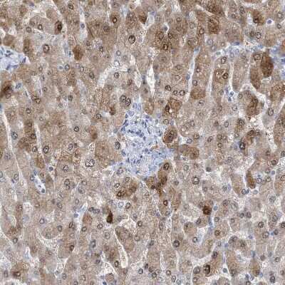 Immunohistochemistry: HMGCS1 Antibody [NBP1-83246] - Staining of human liver shows moderate cytoplasmic positivity in hepatocytes.