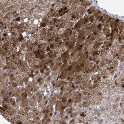 Immunohistochemistry-Paraffin: HMGCS1 Antibody [NBP1-83246] - Staining of human liver shows strong cytoplasmic and nuclear positivity in hepatocytes.