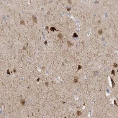 Immunohistochemistry-Paraffin: HMGCS1 Antibody [NBP1-83246] - Staining of human cerebral cortex shows moderate to strong cytoplasmic positivity in neurons.