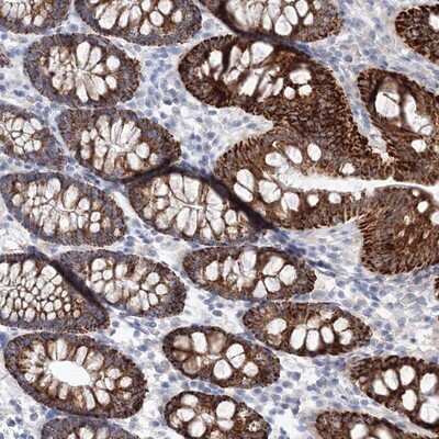 Immunohistochemistry-Paraffin: HMGCS1 Antibody [NBP2-14094] - Staining of human colon shows strong cytoplasmic positivity with a granular pattern in glandular cells.