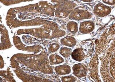 Immunohistochemistry-Paraffin HMGCS1 Antibody