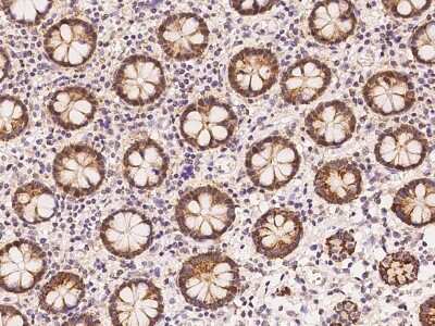 Immunohistochemistry-Paraffin: HMGCS1 Antibody [NBP2-97737] - Immunochemical staining of human HMGCS1 in human large intestine with rabbit polyclonal antibody at 1:100 dilution, formalin-fixed paraffin embedded sections.