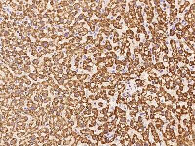 Immunohistochemistry-Paraffin: HMGCS1 Antibody [NBP2-97737] - Immunochemical staining of human HMGCS1 in human liver with rabbit polyclonal antibody at 1:100 dilution, formalin-fixed paraffin embedded sections.