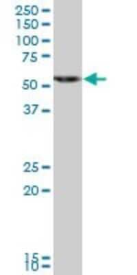 Western Blot: HMGCS1 Antibody [H00003157-B01P] - Analysis of HMGCS1 expression in human liver.