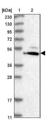 Western Blot: HMGCS1 Antibody [NBP2-14094] - Lane 1: Marker  [kDa] 230, 130, 95, 72, 56, 36, 28, 17, 11.  Lane 2: Human cell line RT-4.