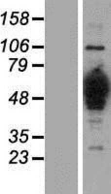 Western Blot: HMGCS1 Overexpression Lysate (Adult Normal) [NBP2-08145] Left-Empty vector transfected control cell lysate (HEK293 cell lysate); Right -Over-expression Lysate for HMGCS1.