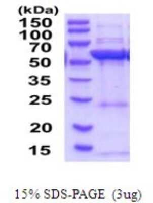 SDS-Page: Recombinant Human HMGCS1 Protein [NBP2-52082] -  15% SDS Page (3 ug)