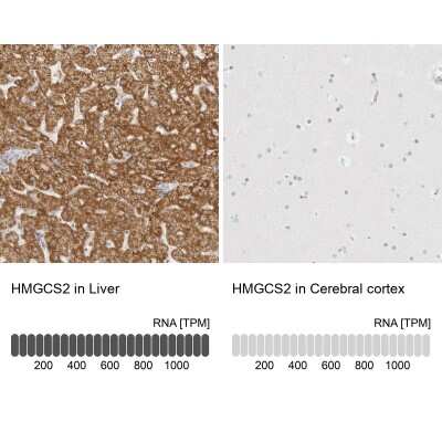 <b>Orthogonal Strategies Validation. </b>Immunohistochemistry-Paraffin: HMGCS2 Antibody [NBP2-33907] - Staining in human liver and cerebral cortex tissues using anti-HMGCS2 antibody. Corresponding HMGCS2 RNA-seq data are presented for the same tissues.