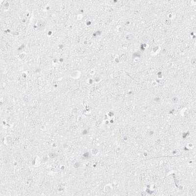 Immunohistochemistry-Paraffin: HMGCS2 Antibody [NBP2-33907] - Staining of human cerebral cortex shows no positivity in neurons as expected.