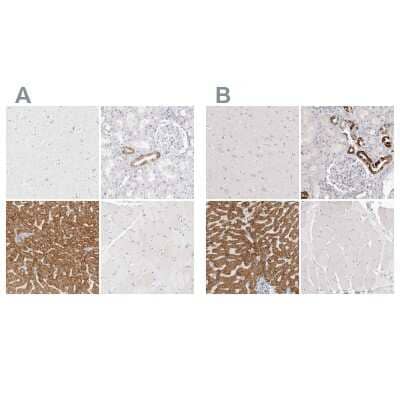 <b>Independent Antibodies Validation. </b>Immunohistochemistry-Paraffin: HMGCS2 Antibody [NBP2-33907] - Staining of human cerebral cortex, kidney, liver and skeletal muscle using Anti-HMGCS2 antibody NBP2-33907 (A) shows similar protein distribution across tissues to independent antibody NBP2-33908 (B).