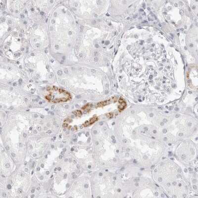 Immunohistochemistry-Paraffin: HMGCS2 Antibody [NBP2-33907] - Staining of human kidney shows moderate granular cytoplasmic positivity in cells in tubules.