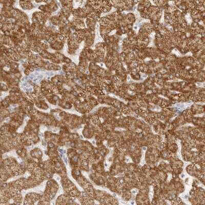 Immunohistochemistry-Paraffin: HMGCS2 Antibody [NBP2-33907] - Staining of human liver shows strong granular cytoplasmic positivity in hepatocytes.