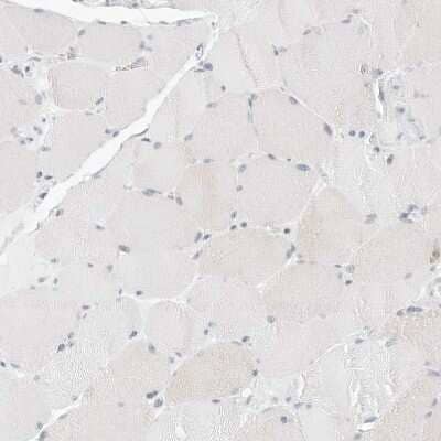 <b>Independent Antibodies Validation. </b>Immunohistochemistry-Paraffin: HMGCS2 Antibody [NBP2-33907] - Staining of human skeletal muscle shows no positivity in myocytes as expected.