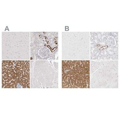 <b>Independent Antibodies Validation. </b>Immunohistochemistry-Paraffin: HMGCS2 Antibody [NBP2-33908] - Staining of human cerebral cortex, kidney, liver and skeletal muscle using Anti-HMGCS2 antibody NBP2-33908 (A) shows similar protein distribution across tissues to independent antibody NBP2-33907 (B).