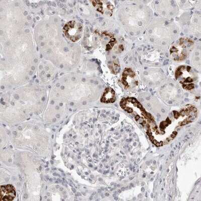 Immunohistochemistry-Paraffin: HMGCS2 Antibody [NBP2-33908] - Staining of human kidney shows strong granular cytoplasmic positivity in cells in tubules.