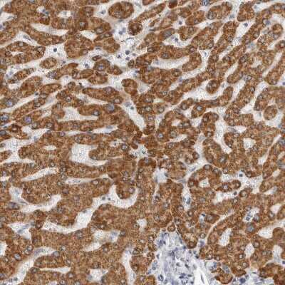Immunohistochemistry-Paraffin: HMGCS2 Antibody [NBP2-33908] - Staining of human liver shows strong granular cytoplasmic positivity in hepatocytes.
