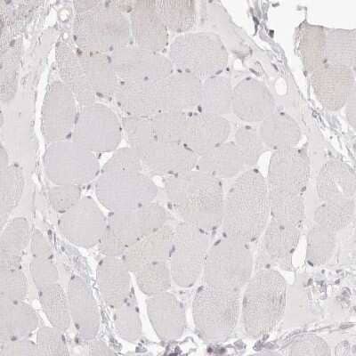 Immunohistochemistry-Paraffin: HMGCS2 Antibody [NBP2-33908] - Staining of human skeletal muscle shows no positivity in myocytes as expected.