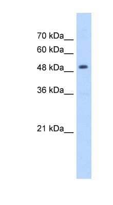 Western Blot: HMGCS2 Antibody [NBP1-54869] - Jurkat cell lysate, concentration 5.0ug/ml.