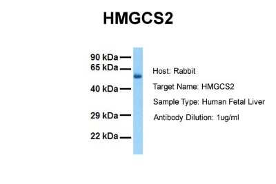 Western Blot: HMGCS2 Antibody [NBP1-54869] - Sample Tissue: Human Fetal Liver Antibody Dilution: 1.0 ug/ml