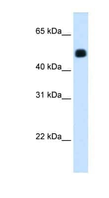 Western Blot: HMGCS2 Antibody [NBP1-54995] - Human Liver cell lysate, concentration 1.25ug/ml.