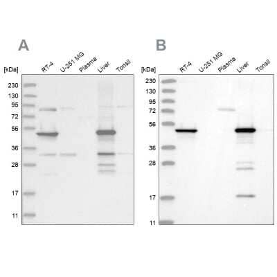 Western Blot HMGCS2 Antibody - BSA Free