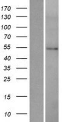 Western Blot: HMGCS2 Overexpression Lysate (Adult Normal) [NBP2-07739] Left-Empty vector transfected control cell lysate (HEK293 cell lysate); Right -Over-expression Lysate for HMGCS2.