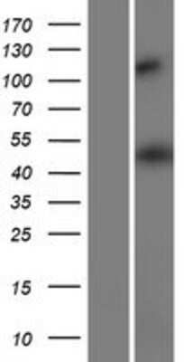 Western Blot HMGCS2 Overexpression Lysate