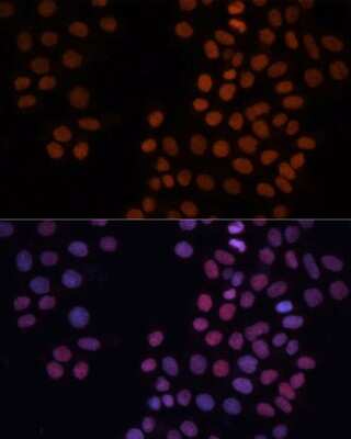 Immunocytochemistry/Immunofluorescence: HMGN1/HMG14 Antibody [NBP3-02946] - Analysis of HeLa cells using HMGN1/HMG14 antibody at dilution of 1:100. Blue: DAPI for nuclear staining.