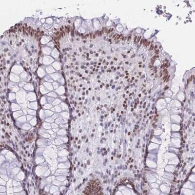 Immunohistochemistry-Paraffin: HMGN1/HMG14 Antibody [NBP2-47433] - Staining of human rectum shows moderate nuclear positivity in glandular cells.