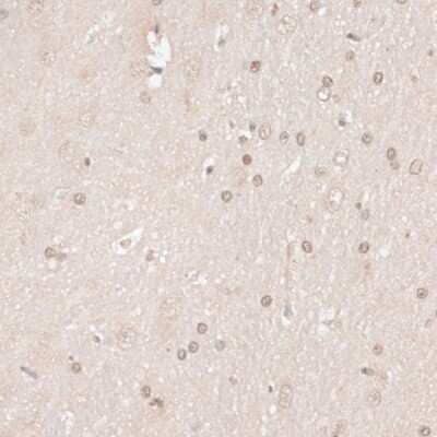 Immunohistochemistry-Paraffin: HMGN1/HMG14 Antibody [NBP3-03219] - Immunohistochemistry of paraffin-embedded rat brain using HMGN1/HMG14 antibody (NBP3-03219) at dilution of 1:100 (40x lens). Perform microwave antigen retrieval with 10 mM PBS buffer pH 7.2 before commencing with IHC staining protocol.