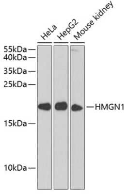 Western Blot: HMGN1/HMG14 Antibody [NBP3-02946] - Analysis of extracts of various cell lines, using HMGN1/HMG14 antibody at 1:1000 dilution. Secondary antibody: HRP Goat Anti-Rabbit IgG (H+L) at 1:10000 dilution. Lysates/proteins: 25ug per lane. Blocking buffer: 3% nonfat dry milk in TBST. Detection:Basic ECL Kit