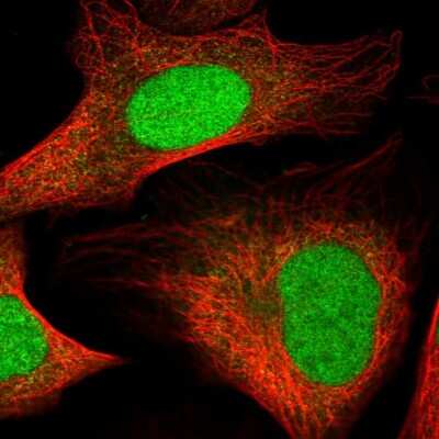 Immunocytochemistry/Immunofluorescence: HMGN3/TRIP7 Antibody [NBP1-86904] - Staining of human cell line U-2 OS shows localization to nucleoplasm.