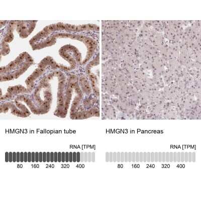 <b>Orthogonal Strategies Validation. </b>Immunohistochemistry-Paraffin: HMGN3/TRIP7 Antibody [NBP2-62640] - Immunohistochemistry analysis in human fallopian tube and pancreas tissues using Anti-HMGN3 antibody. Corresponding HMGN3 RNA-seq data are presented for the same tissues.