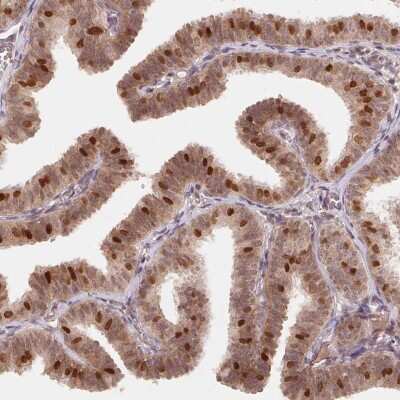 Immunohistochemistry-Paraffin: HMGN3/TRIP7 Antibody [NBP2-62640] - Staining of human fallopian tube shows high expression.