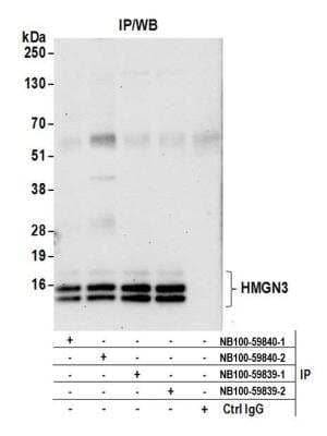 <b>Independent Antibodies Validation. </b>Immunoprecipitation: HMGN3/TRIP7 Antibody [NB100-59839] - Detection of human HMGN3 by western blot of immunoprecipitates. Samples: Whole cell lysate (0.5 or 1.0 mg per IP reaction; 20% of IP loaded) from HeLa cells prepared using NETN lysis buffer. Antibodies: Affinity purified rabbit anti-HMGN3 antibody NB100-59839 (lot 2) used for IP at 6 ug per reaction. HMGN3 was also immunoprecipitated with a previous lot of this antibody (lot 1) and rabbit anti-HMGN3 antibody NB100-59840 (lots 1 and 2). For blotting immunoprecipitated HGMN3, NB100-59840 was used at 1 ug/ml. Detection: Chemiluminescence with an exposure time of 30 seconds.