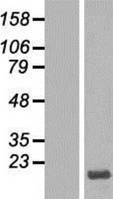 Western Blot: HMGN3/TRIP7 Overexpression Lysate (Adult Normal) [NBP2-10576] Left-Empty vector transfected control cell lysate (HEK293 cell lysate); Right -Over-expression Lysate for HMGN3/TRIP7.