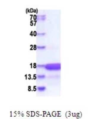 SDS-Page: HMGN3/TRIP7 Recombinant Protein [NBP2-51809] - 15% SDS Page (3 ug)