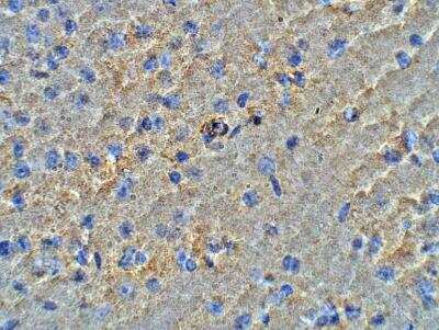Immunohistochemistry-Paraffin HMP19 Antibody