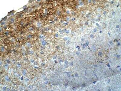 Immunohistochemistry-Paraffin HMP19 Antibody