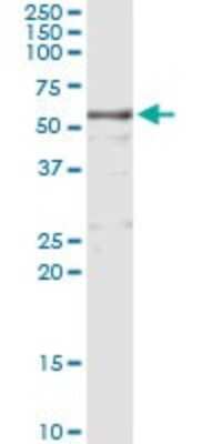 Immunoprecipitation: HMW Kininogen Antibody (4A1) [H00003827-M02] - Analysis of KNG1 transfected lysate using anti-KNG1 monoclonal antibody and Protein A Magnetic Bead, and immunoblotted with KNG1 MaxPab rabbit polyclonal antibody.
