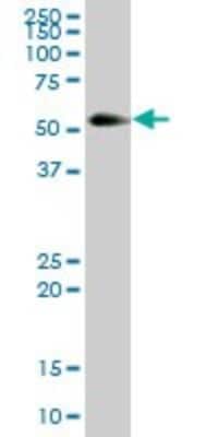 Western Blot: Kininogen Antibody [H00003827-B01P] - Analysis of Kininogen expression in human pancreas.