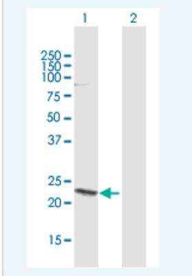 Western Blot: HN1 Antibody [H00051155-B01P-50ug] - Analysis of HN1 expression in transfected 293T cell line (H00051155-T01) by HN1 MaxPab polyclonal antibody.  Lane 1: HN1 transfected lysate(16.94 KDa). Lane 2: Non-transfected lysate.