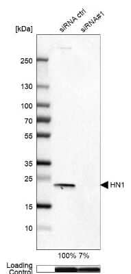 <b>Genetic Strategies Validation. </b>Western Blot: HN1 Antibody [NBP2-32492] - Analysis in A-549 cells transfected with control siRNA, target specific siRNA probe #1, using Anti-HN1 antibody. Remaining relative intensity is presented. Loading control: Anti-GAPDH.
