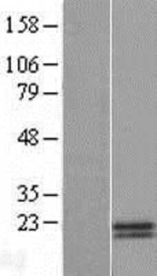 Western Blot: HN1 Overexpression Lysate (Adult Normal) [NBP2-08945] Left-Empty vector transfected control cell lysate (HEK293 cell lysate); Right -Over-expression Lysate for HN1.